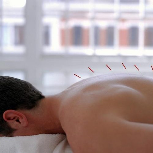 How does acupuncture work?
